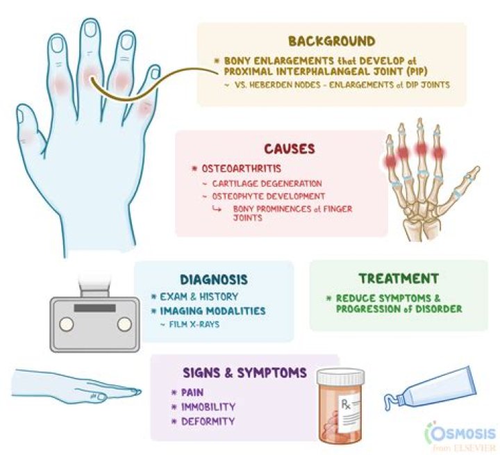 Can you get PIP for osteoarthritis?