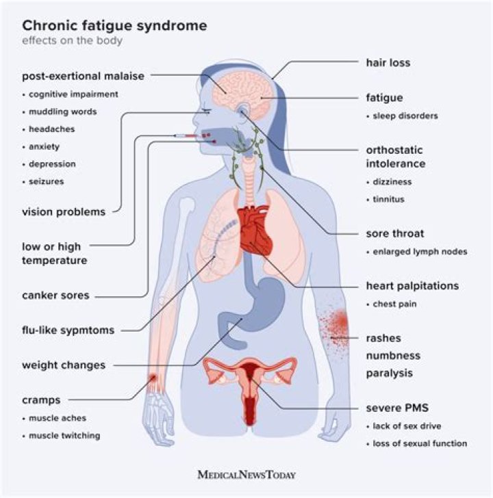 Does chronic fatigue ever go away?