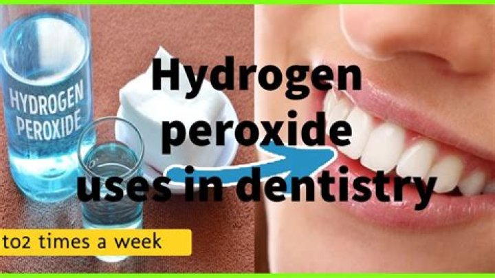 Does hydrogen peroxide get rid of plaque?