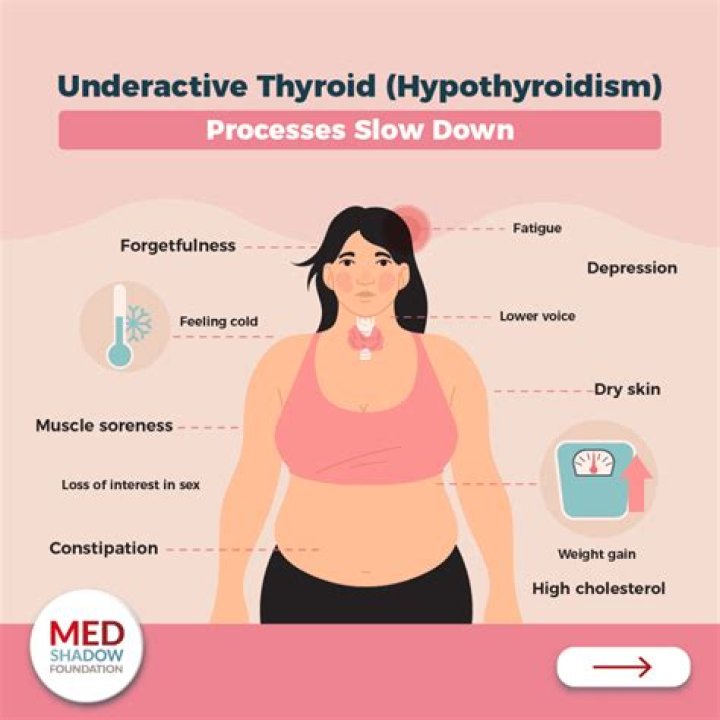 Does hypothyroidism get worse in winter?