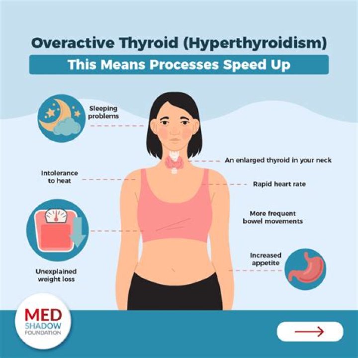 Does thyroid make your heart beat fast?