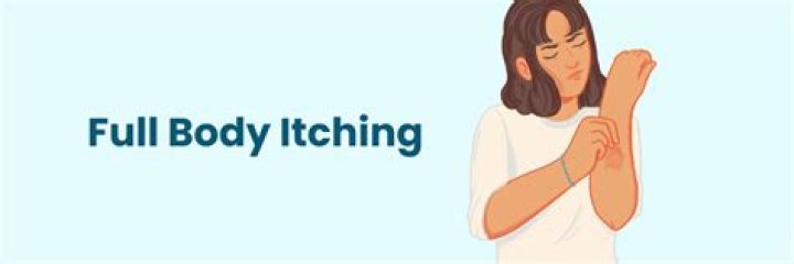 How do I stop uncontrollable itching all over my body?