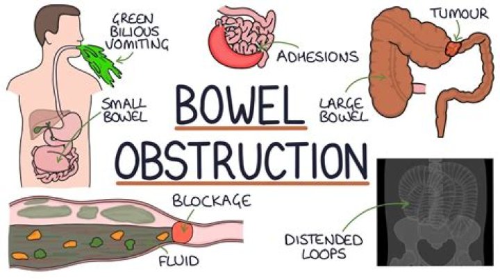 How do you know if your child has bowel problems?