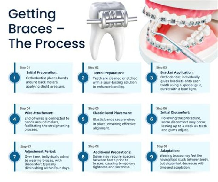 How long does your teeth hurt after getting your braces tightened?
