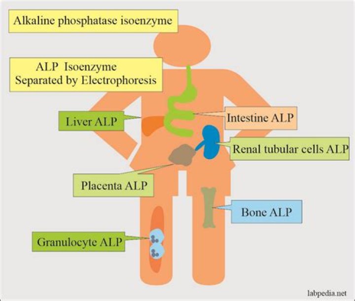What autoimmune disease causes elevated alkaline phosphatase?